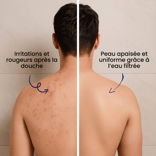 LE POMMEAU DE DOUCHE FILTRÉ™