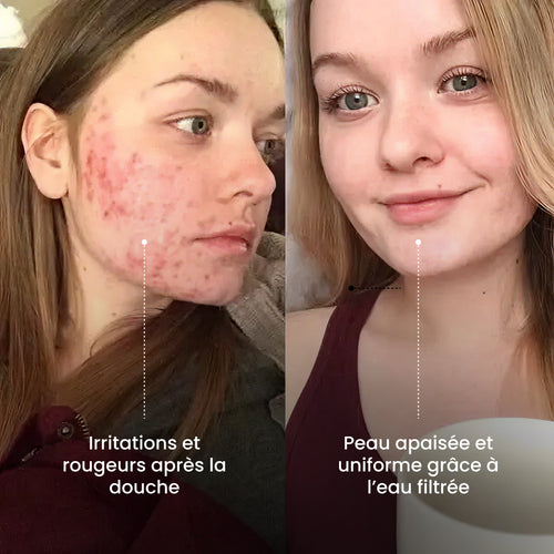 LE POMMEAU DE DOUCHE FILTRÉ™