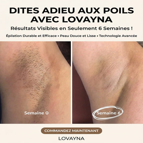 Épilation définitive à la lumière pulsée