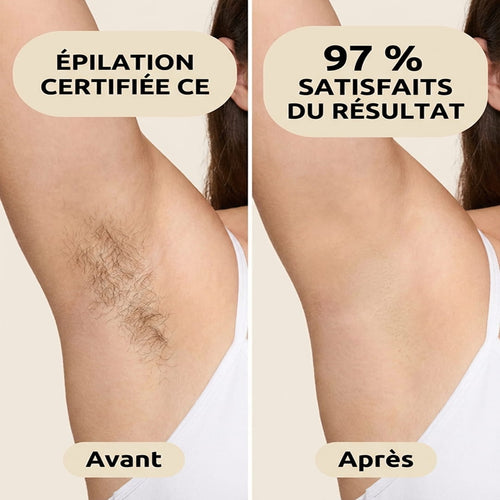 Épilation définitive à la lumière pulsée