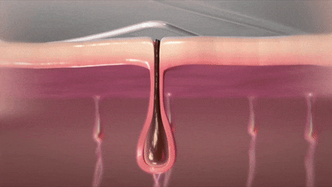 Convient à toutes les parties du corps